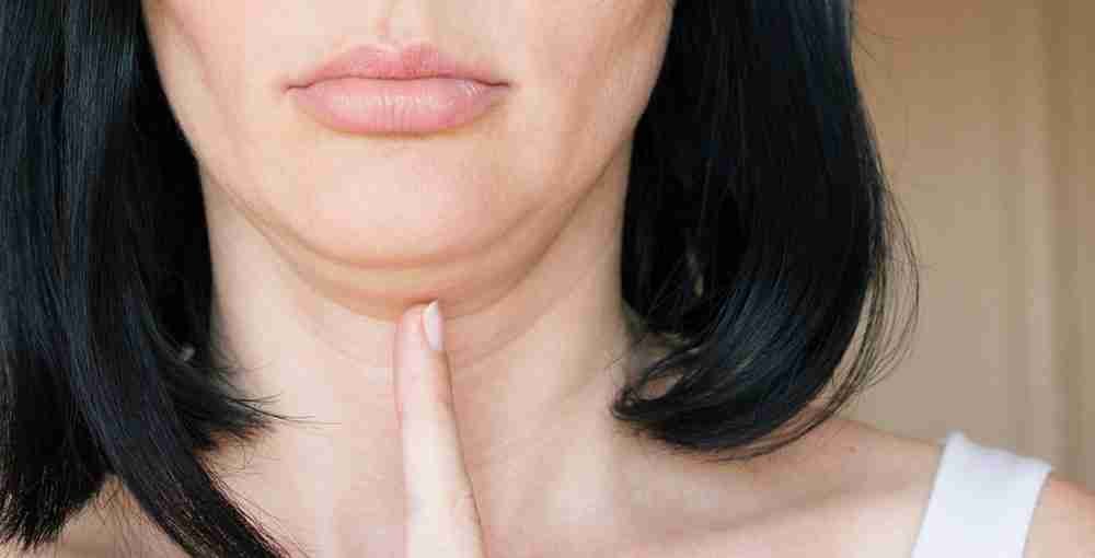 Double chin treatment