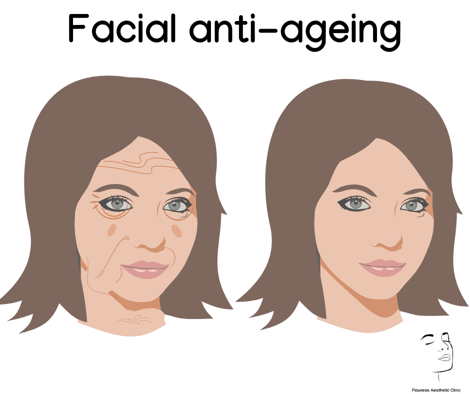 Facial ageing triangle