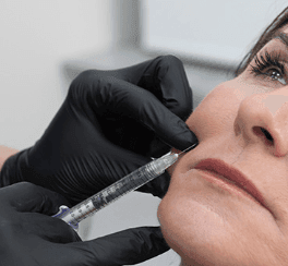 Dermal Filler Injection with Needle