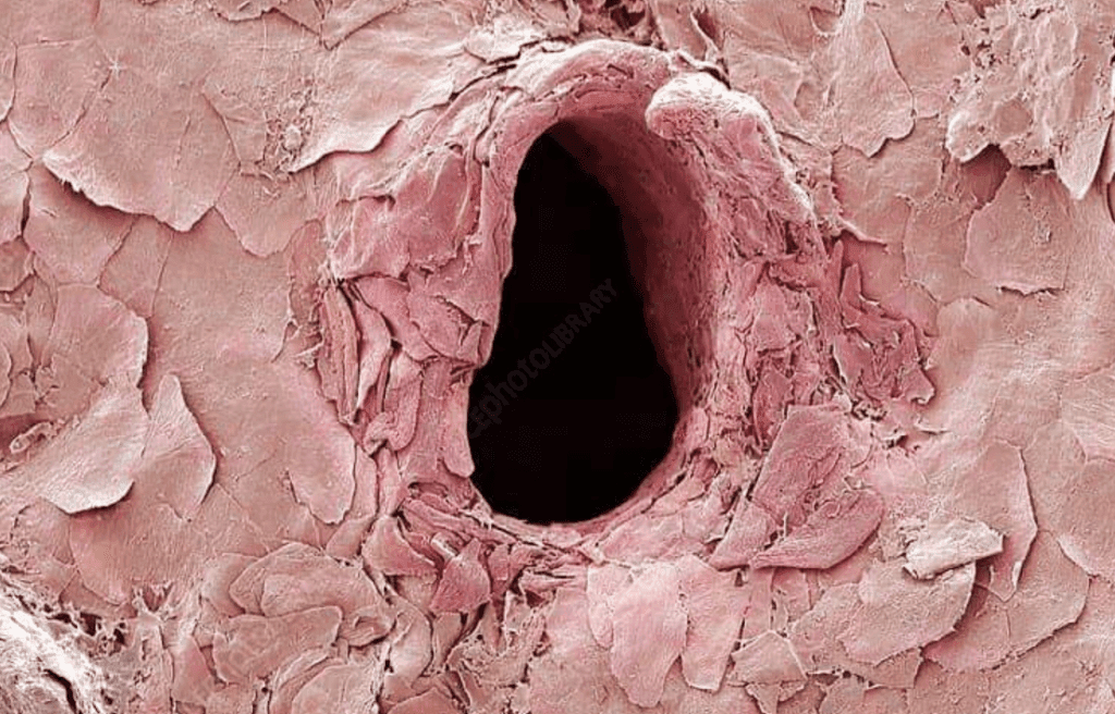 skin after needle Viral photo of skin after needle injection