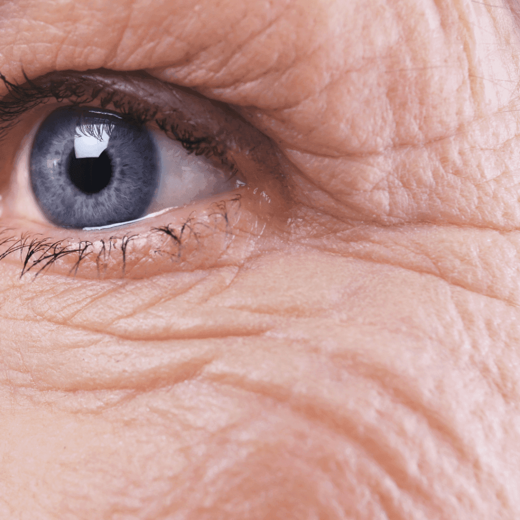 top 5 causes of wrinkles BOTOX NEAR ME