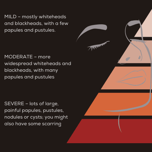 Acne Severity Scale
